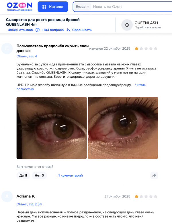 Queenlash отзывы: что скрывается за обещаниями роста ресниц?